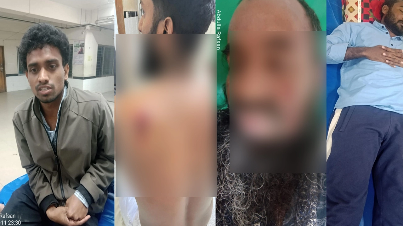চরফ্যাশনে সংঘর্ষ, জামায়াত ও ইসলামী আন্দোলনের ২৯ জন আহত
